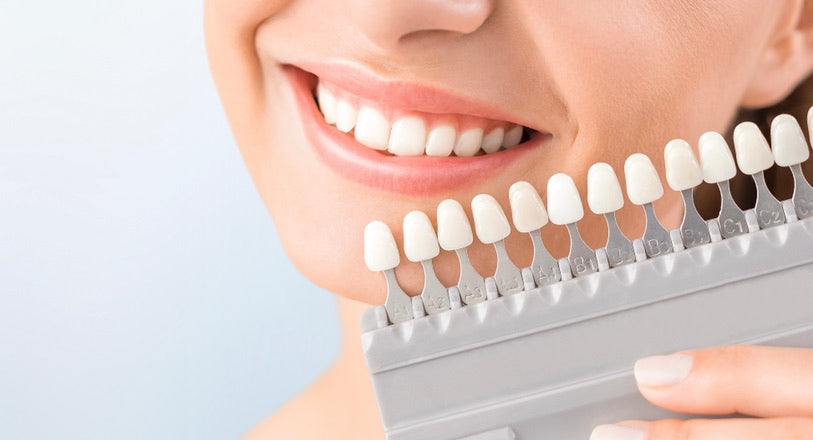 Professional Teeth whitening kits